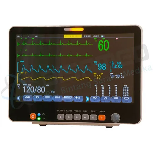 Patient Monitor 5 Parameter